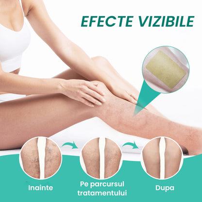 Plasturi pentru Varice – Tratament Natural Rapid | Ameliorare Varice - 12 plasturi